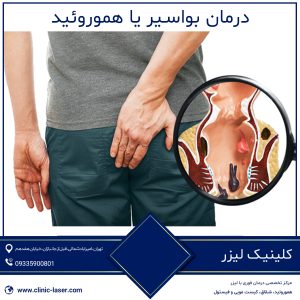 درمان بواسیر یا هموروئید