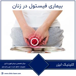 بیماری فیستول در زنان