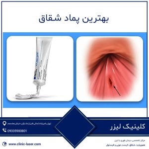 بهترین پماد شقاق